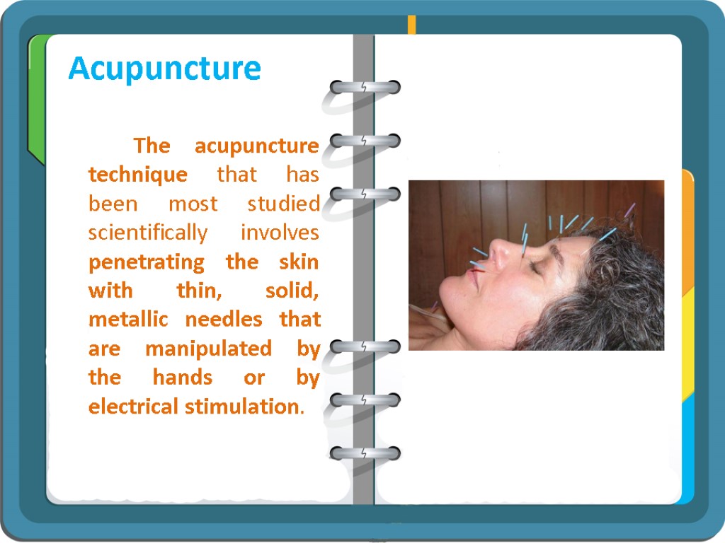 Acupuncture The acupuncture technique that has been most studied scientifically involves penetrating the skin